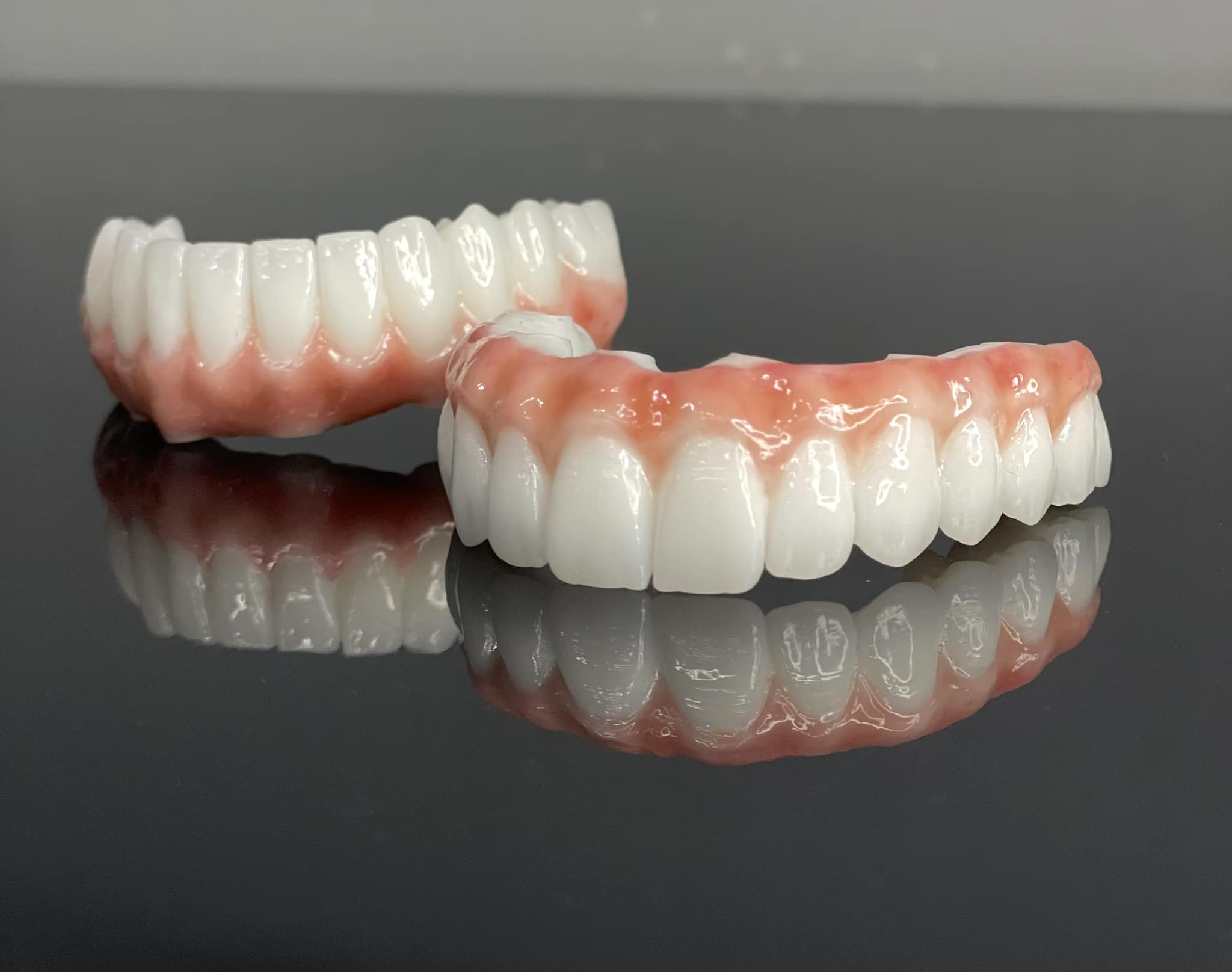 keramičke krunice – protetski rad