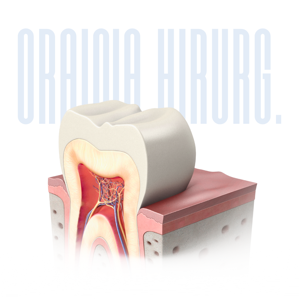 oralna hirurgija – zahvat